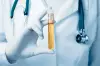 Diagnostic test kits